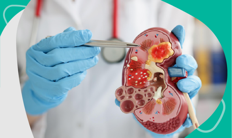 Anatomía del Riñón: Estructura y Función – Renium